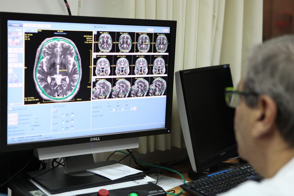 A Rambam neurosurgeon examines brain MRI images