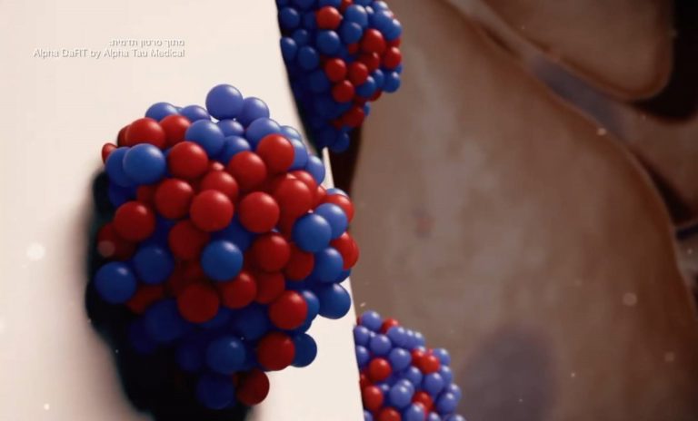 Will the Israeli Start-Up Nation Change the Way we Treat Skin Cancer?